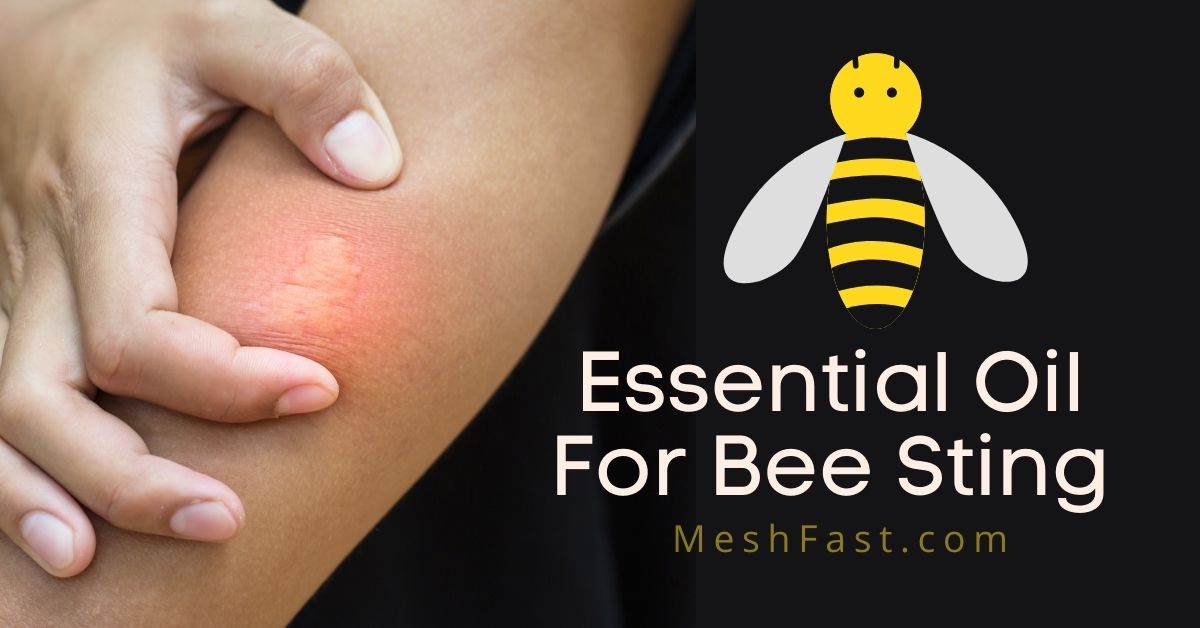 Essential Oil For Bee Sting